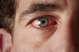視界の黒い点：飛蚊症